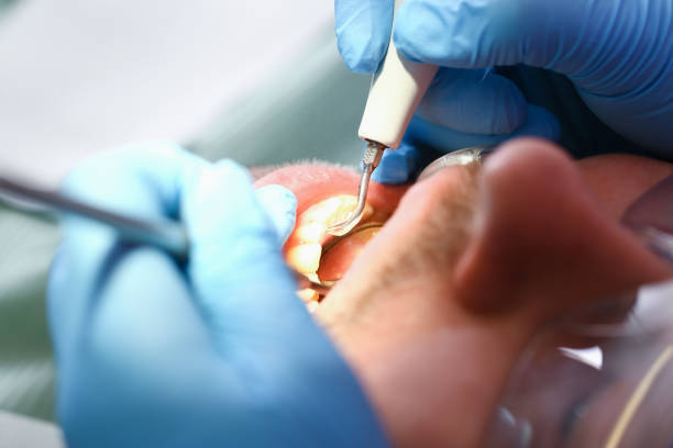 Best Urgent Dental Care for Toothache in Merrionette Park, IL