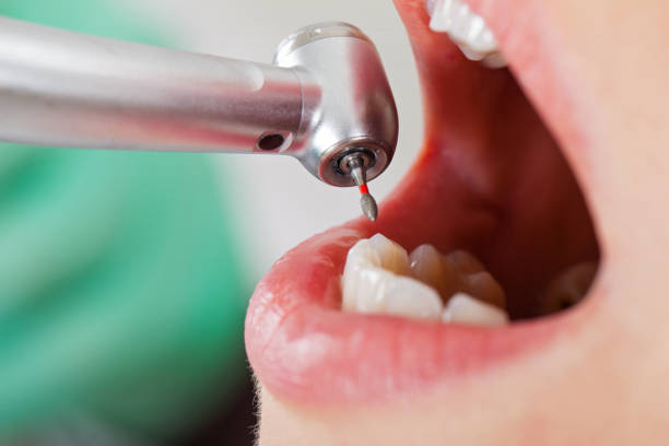 Best Holiday Emergency Dentist in Merrionette Park, IL